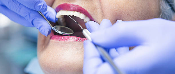 Best Emergency Dental Care for Sports Injuries in Cashmere, WA
